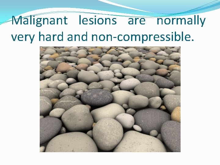 Malignant lesions are normally very hard and non-compressible. 