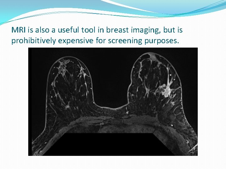 MRI is also a useful tool in breast imaging, but is prohibitively expensive for
