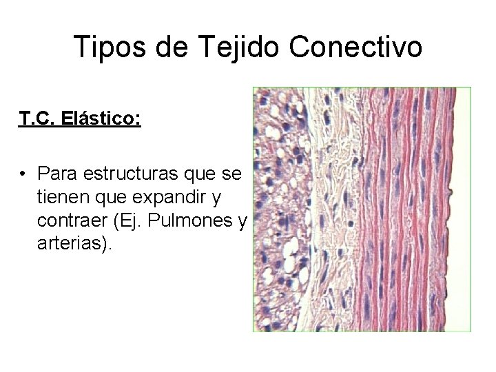 Tipos de Tejido Conectivo T. C. Elástico: • Para estructuras que se tienen que