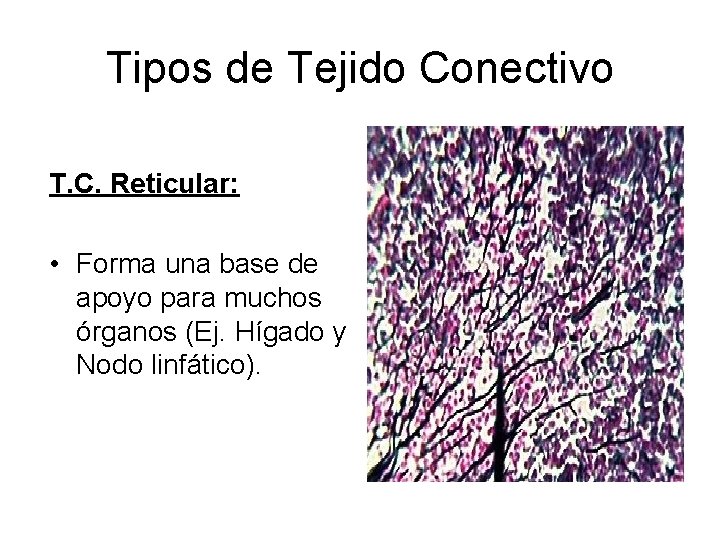 Tipos de Tejido Conectivo T. C. Reticular: • Forma una base de apoyo para