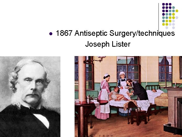 l 1867 Antiseptic Surgery/techniques Joseph Lister 