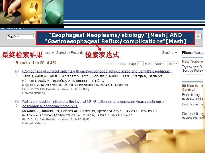 "Esophageal Neoplasms/etiology"[Mesh] AND "Gastroesophageal Reflux/complications"[Mesh] 最终检索结果 检索表达式 