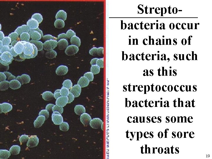 Streptobacteria occur in chains of bacteria, such as this streptococcus bacteria that causes some