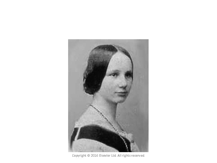 Copyright © 2016 Elsevier Ltd. All rights reserved. 