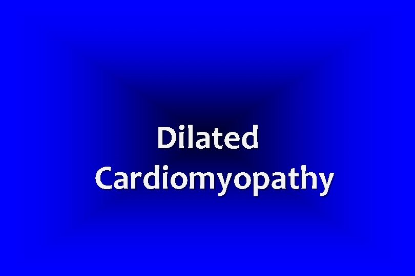 Dilated Cardiomyopathy 