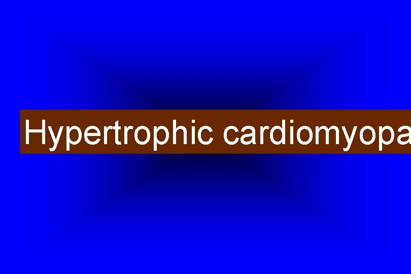 Hypertrophic cardiomyopa 