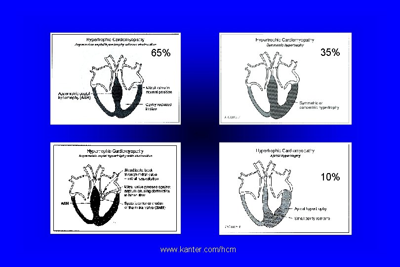 65% 35% 10% www. kanter. com/hcm 