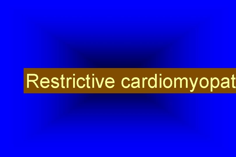 Restrictive cardiomyopat 