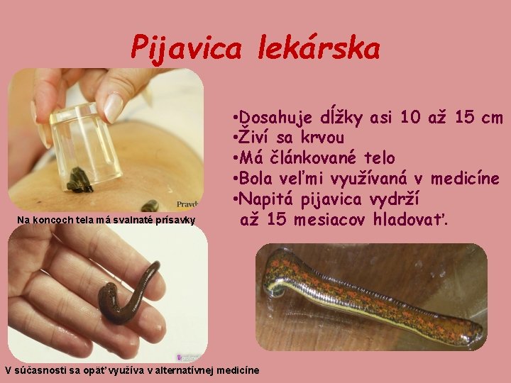 Pijavica lekárska Na koncoch tela má svalnaté prísavky • Dosahuje dĺžky asi 10 až