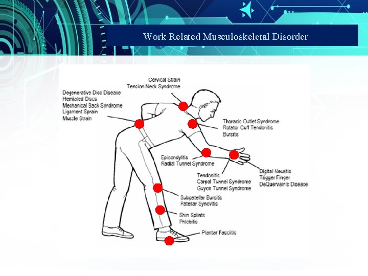 Work Related Musculoskeletal Disorder 