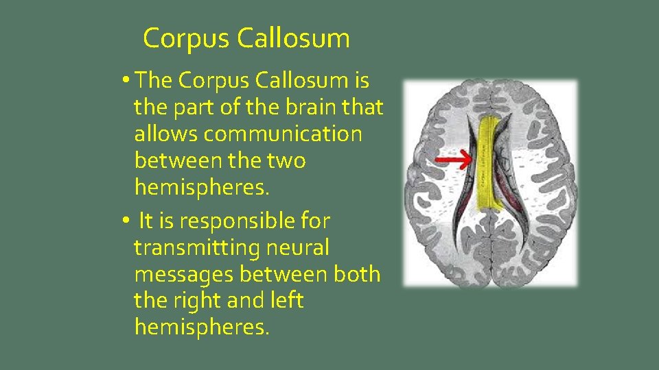Corpus Callosum • The Corpus Callosum is the part of the brain that allows