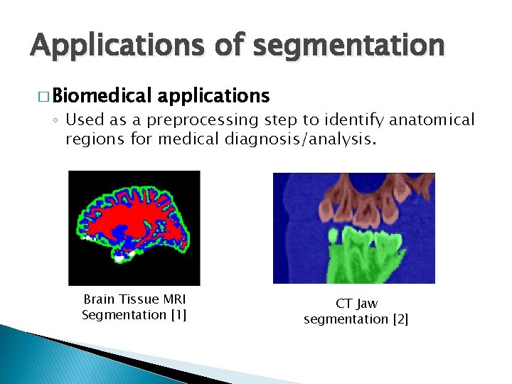 Applications of segmentation � Biomedical applications ◦ Used as a preprocessing step to identify
