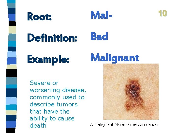 Root: Mal- Definition: Bad Example: Malignant Severe or worsening disease, commonly used to describe