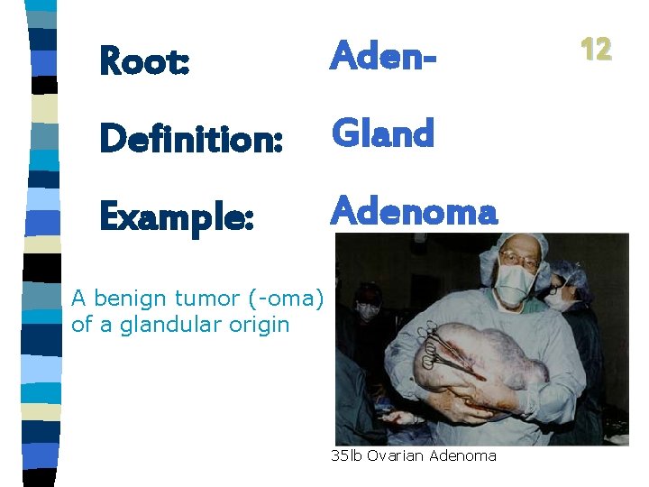 Root: Aden- Definition: Gland Example: Adenoma A benign tumor (-oma) of a glandular origin