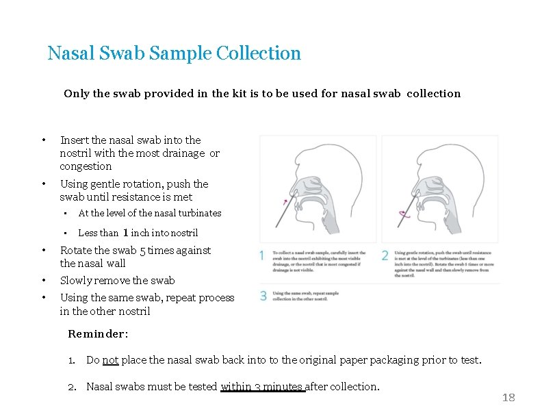Nasal Swab Sample Collection Only the swab provided in the kit is to be