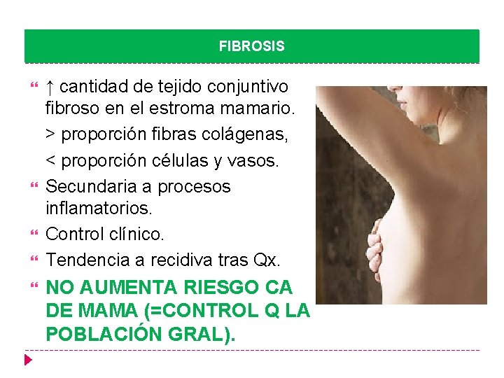 FIBROSIS ↑ cantidad de tejido conjuntivo fibroso en el estroma mamario. > proporción fibras