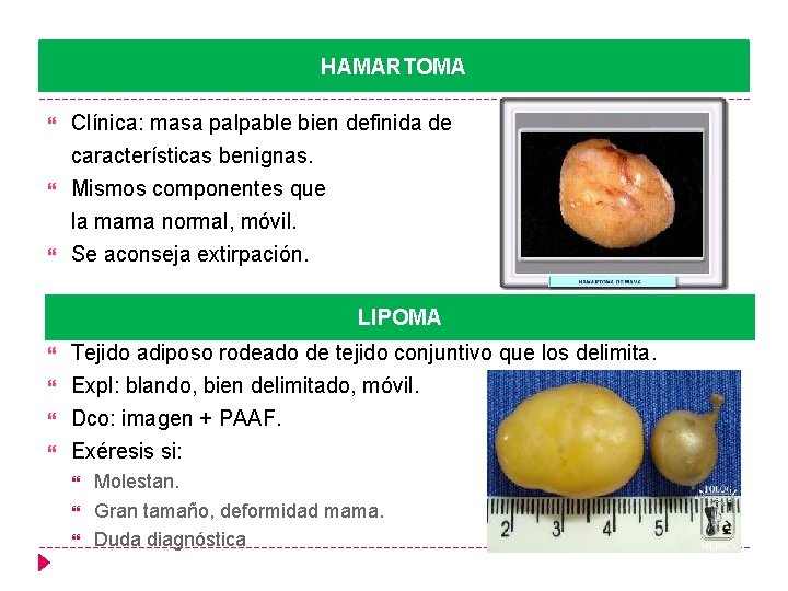 HAMARTOMA Clínica: masa palpable bien definida de características benignas. Mismos componentes que la mama