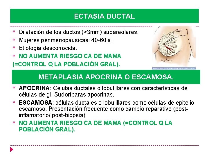 ECTASIA DUCTAL Dilatación de los ductos (>3 mm) subareolares. Mujeres perimenopaúsicas: 40 -60 a.
