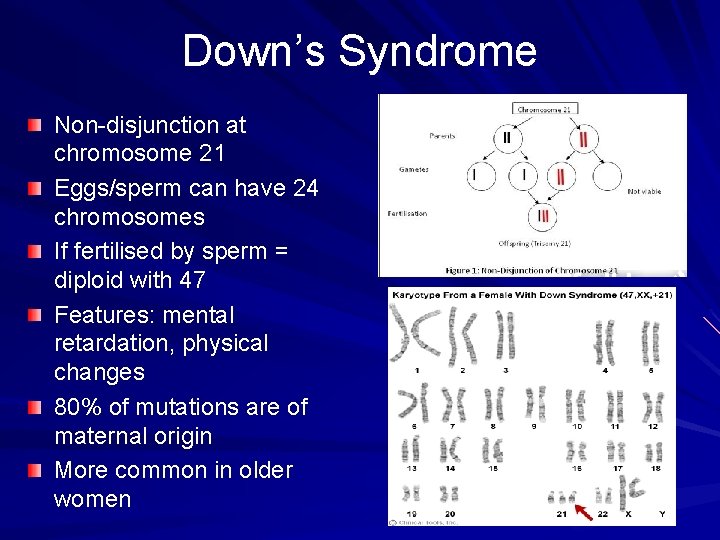 Down’s Syndrome Non-disjunction at chromosome 21 Eggs/sperm can have 24 chromosomes If fertilised by