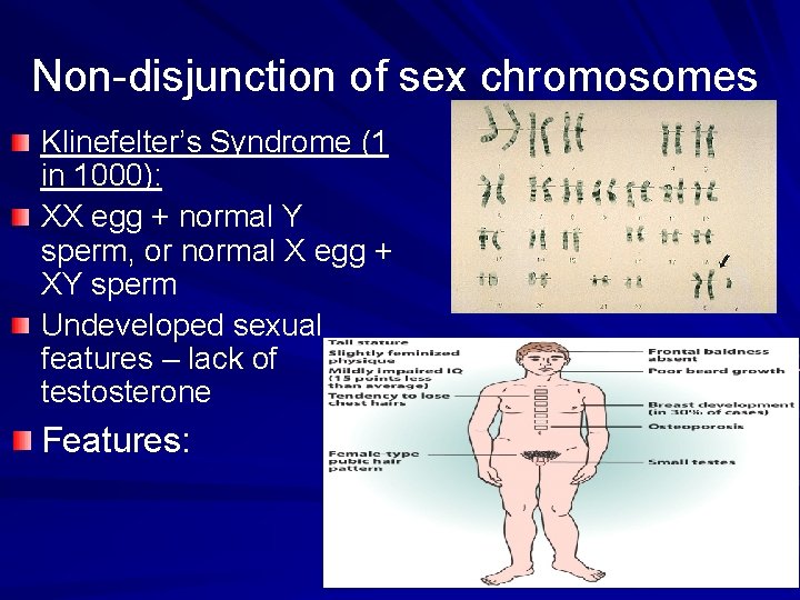 Non-disjunction of sex chromosomes Klinefelter’s Syndrome (1 in 1000): XX egg + normal Y