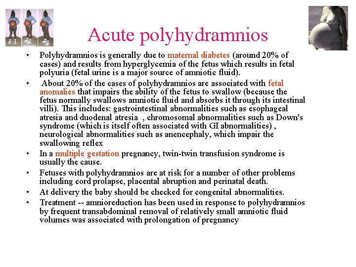 Acute polyhydramnios • • • Polyhydramnios is generally due to maternal diabetes (around 20%