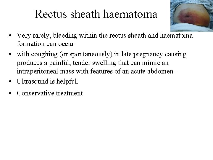 Rectus sheath haematoma • Very rarely, bleeding within the rectus sheath and haematoma formation