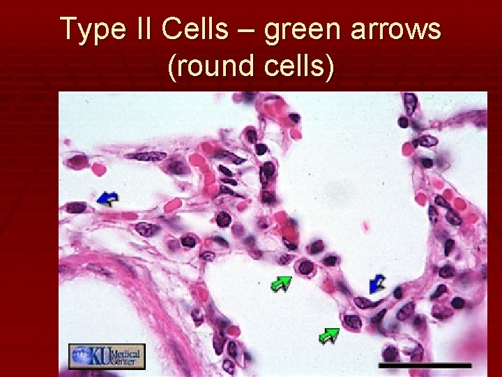 Type II Cells – green arrows (round cells) 