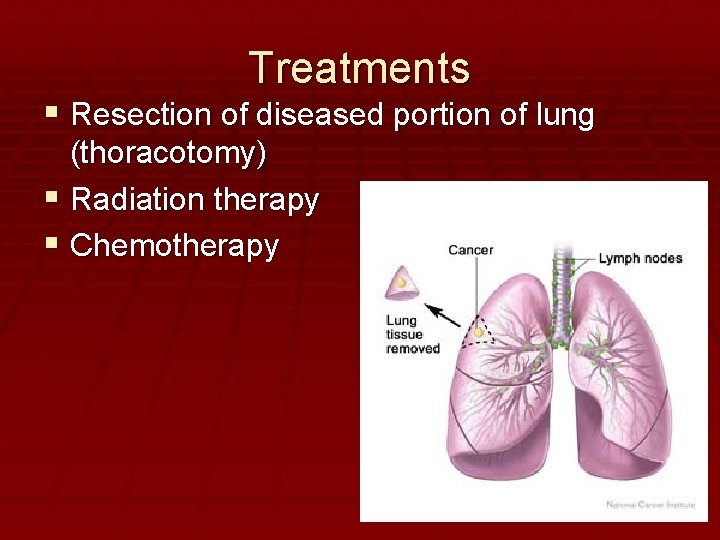 Treatments Resection of diseased portion of lung (thoracotomy) Radiation therapy Chemotherapy 