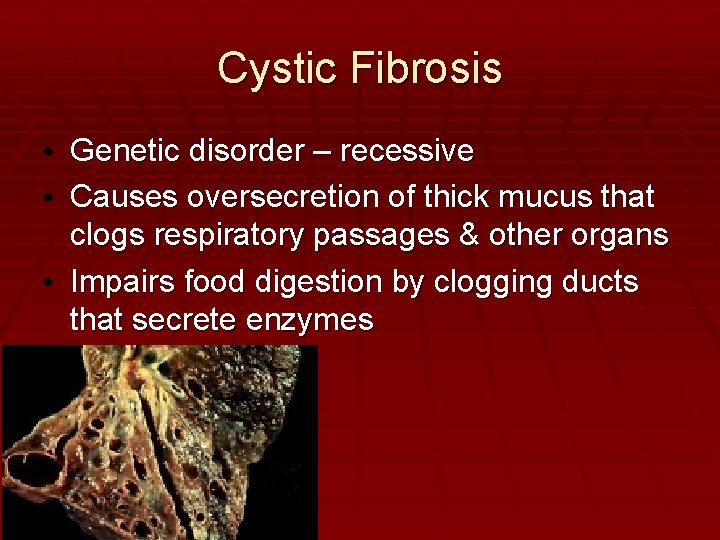 Cystic Fibrosis • Genetic disorder – recessive • Causes oversecretion of thick mucus that