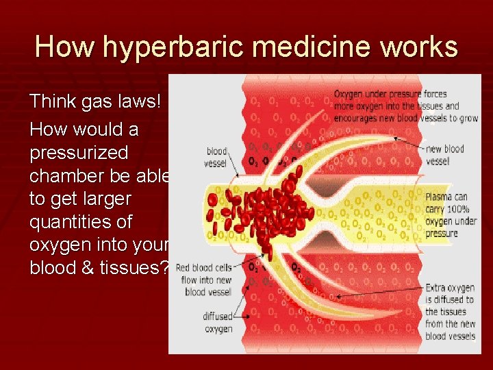 How hyperbaric medicine works Think gas laws! How would a pressurized chamber be able