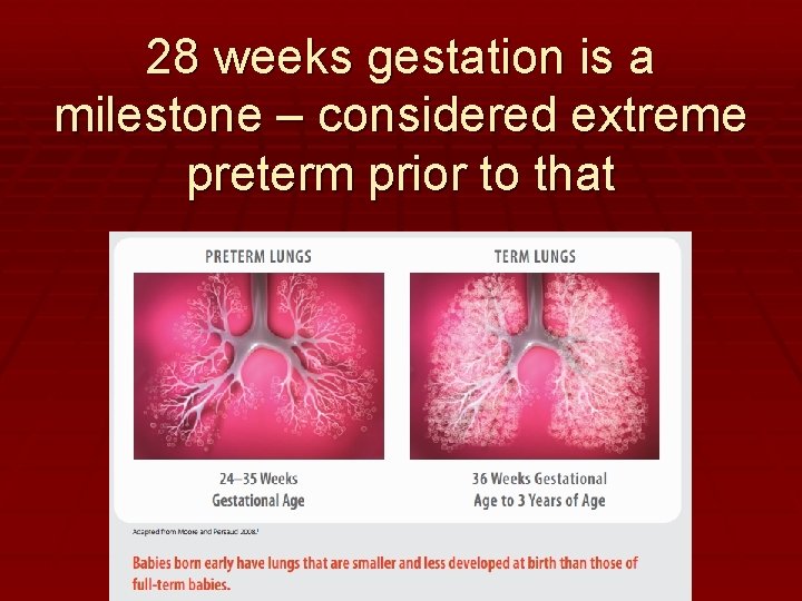 28 weeks gestation is a milestone – considered extreme preterm prior to that 