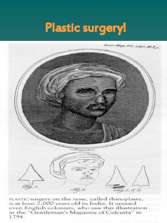 Plastic surgery! 
