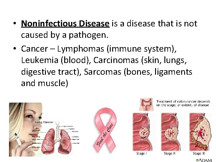  • Noninfectious Disease is a disease that is not caused by a pathogen.
