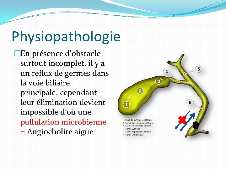 Physiopathologie �En présence d’obstacle surtout incomplet, il y a un reflux de germes dans