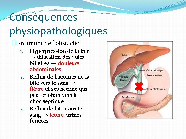 Conséquences physiopathologiques �En amont de l’obstacle: Hyperpression de la bile → dilatation des voies