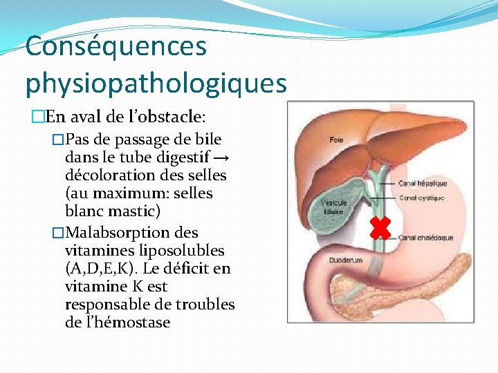 Conséquences physiopathologiques �En aval de l’obstacle: �Pas de passage de bile dans le tube
