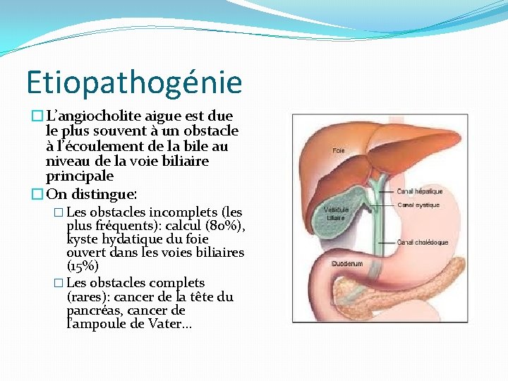 Etiopathogénie �L’angiocholite aigue est due le plus souvent à un obstacle à l’écoulement de
