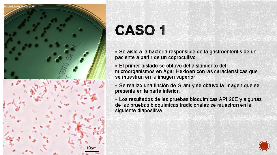 § Se aisló a la bacteria responsible de la gastroenteritis de un paciente a