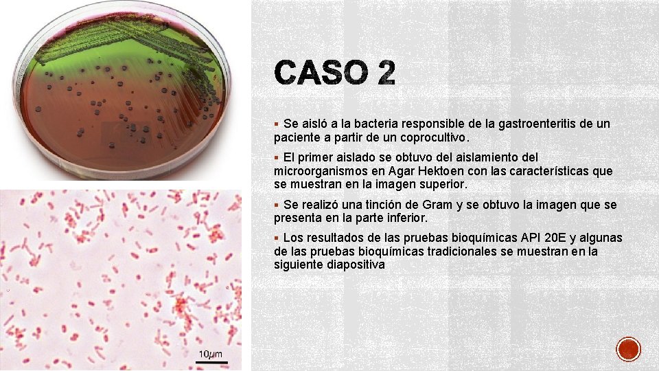 § Se aisló a la bacteria responsible de la gastroenteritis de un paciente a