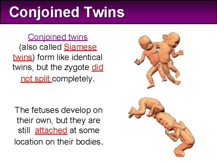 Conjoined Twins Conjoined twins (also called Siamese twins) form like identical twins, but the