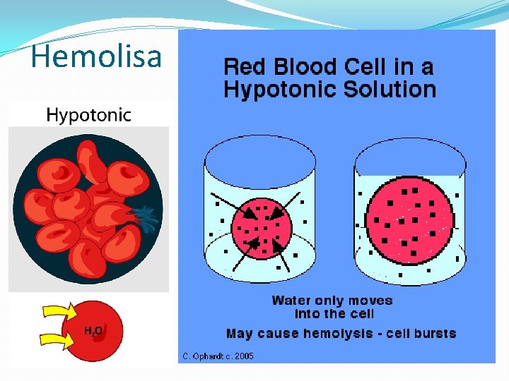 Hemolisa 