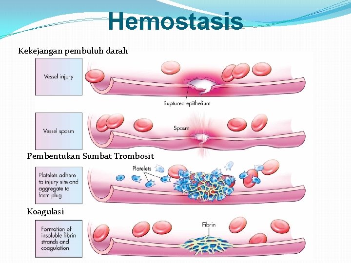 Hemostasis Kekejangan pembuluh darah Pembentukan Sumbat Trombosit Koagulasi 