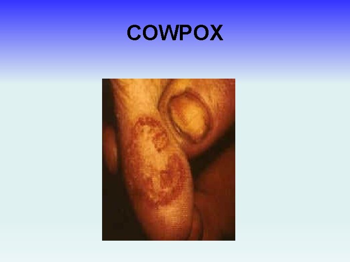 COWPOX 
