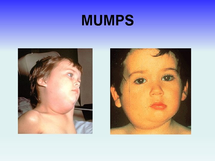 MUMPS 