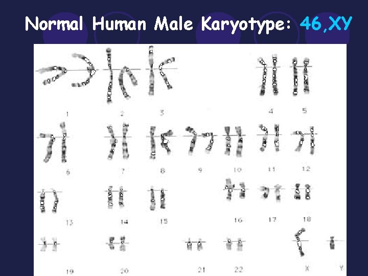 Normal Human Male Karyotype: 46, XY Normal Human Male Karyotype: 46, XY