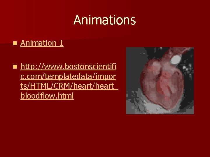 Animations n Animation 1 n http: //www. bostonscientifi c. com/templatedata/impor ts/HTML/CRM/heart_ bloodflow. html Animations n Animation 1 n http: //www. bostonscientifi c. com/templatedata/impor ts/HTML/CRM/heart_ bloodflow. html