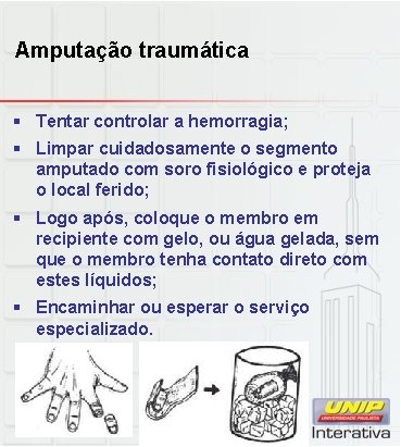 Amputação traumática § Tentar controlar a hemorragia; § Limpar cuidadosamente o segmento amputado com