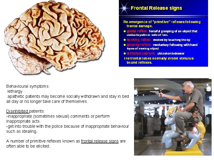 Behavioural symptoms: lethargy apathetic patients may become socially withdrawn and stay in bed all