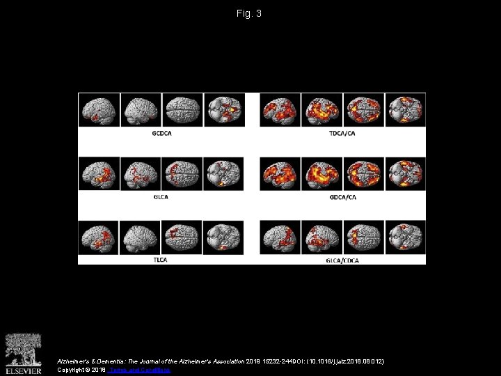 Fig. 3 Alzheimer's & Dementia: The Journal of the Alzheimer's Association 2019 15232 -244