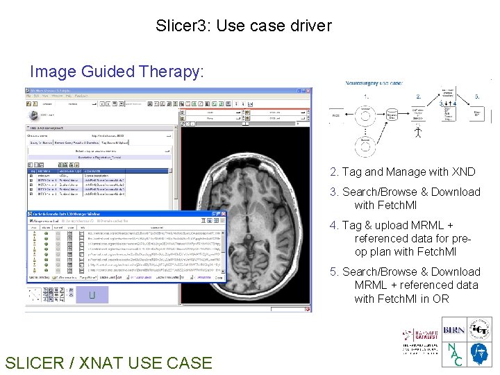Slicer 3: Use case driver Image Guided Therapy: 2. Tag and Manage with XND